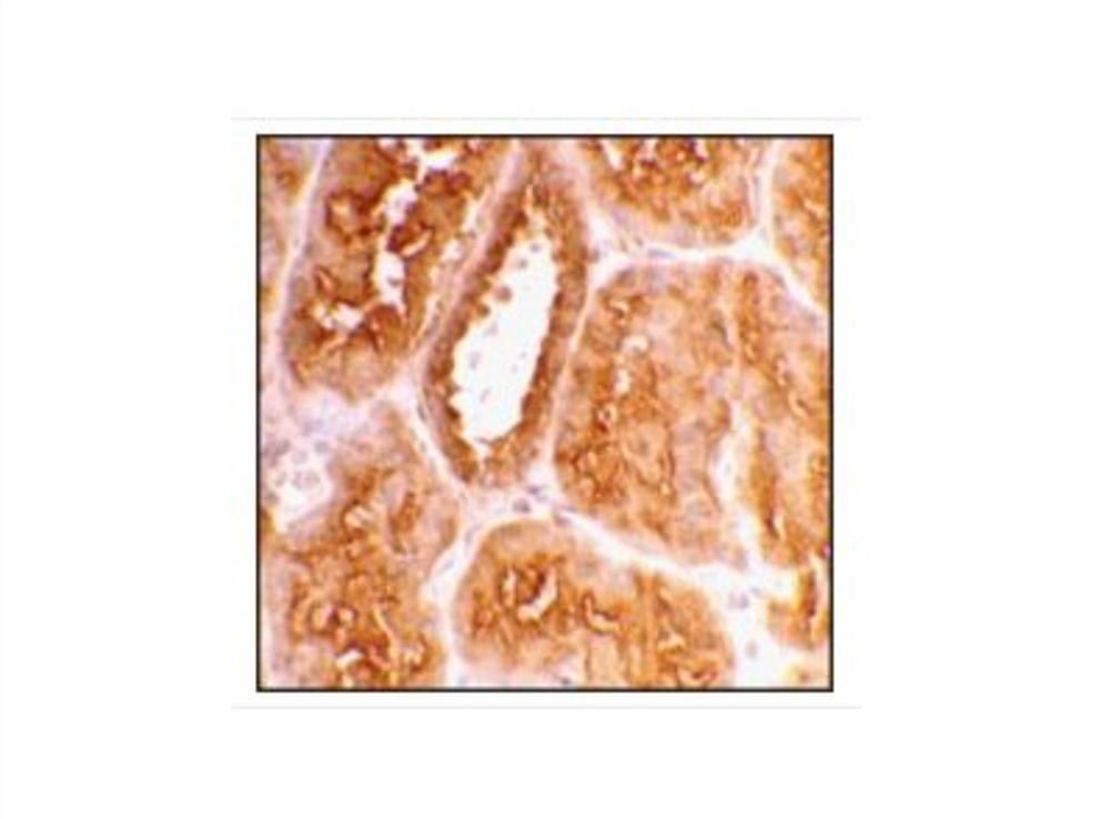 Picture of Anti-ACE2 antibody produced in rabbit
